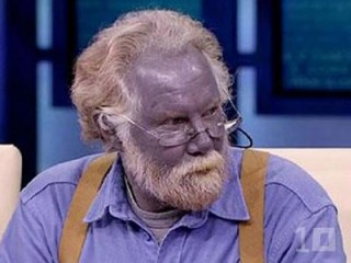 colloidal silver man who turned blue colloidal silver man who turned blue